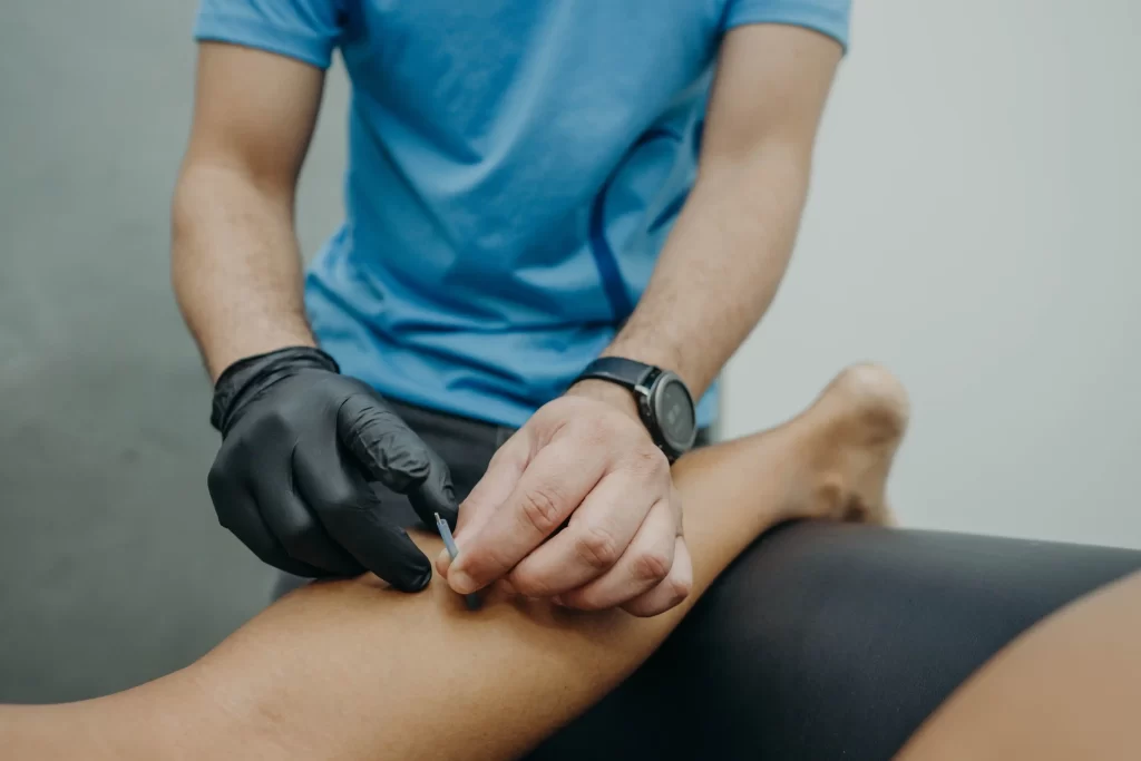 Aplicação da técnica de dry needling na Clínica FisioLeve