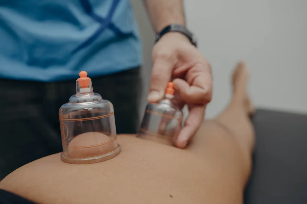Aplicação de ventosaterapia na Clínica FisioLeve